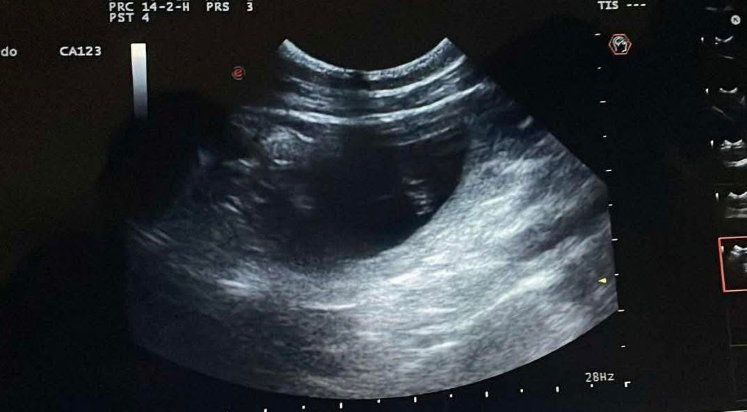 Bientôt des bébés à la maison
